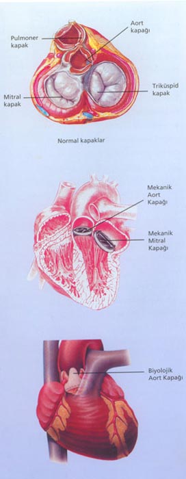Kalp kapak hastalıkları
